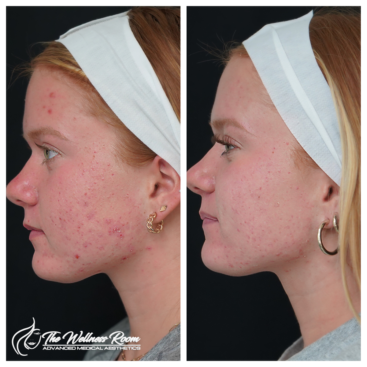 The Wellness Room Skin Wellness Center Knoxville