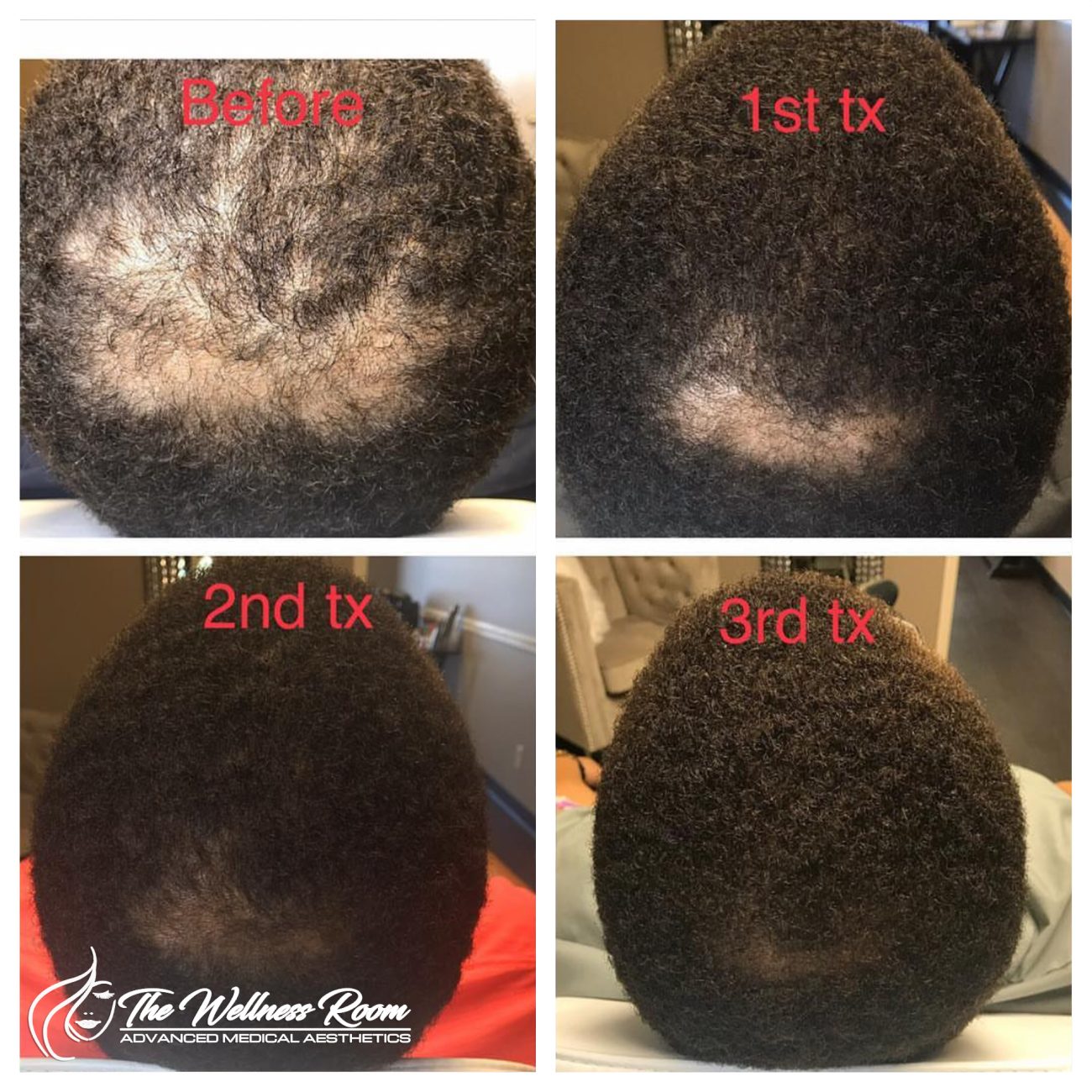 The Wellness Room Skin Wellness Center Knoxville