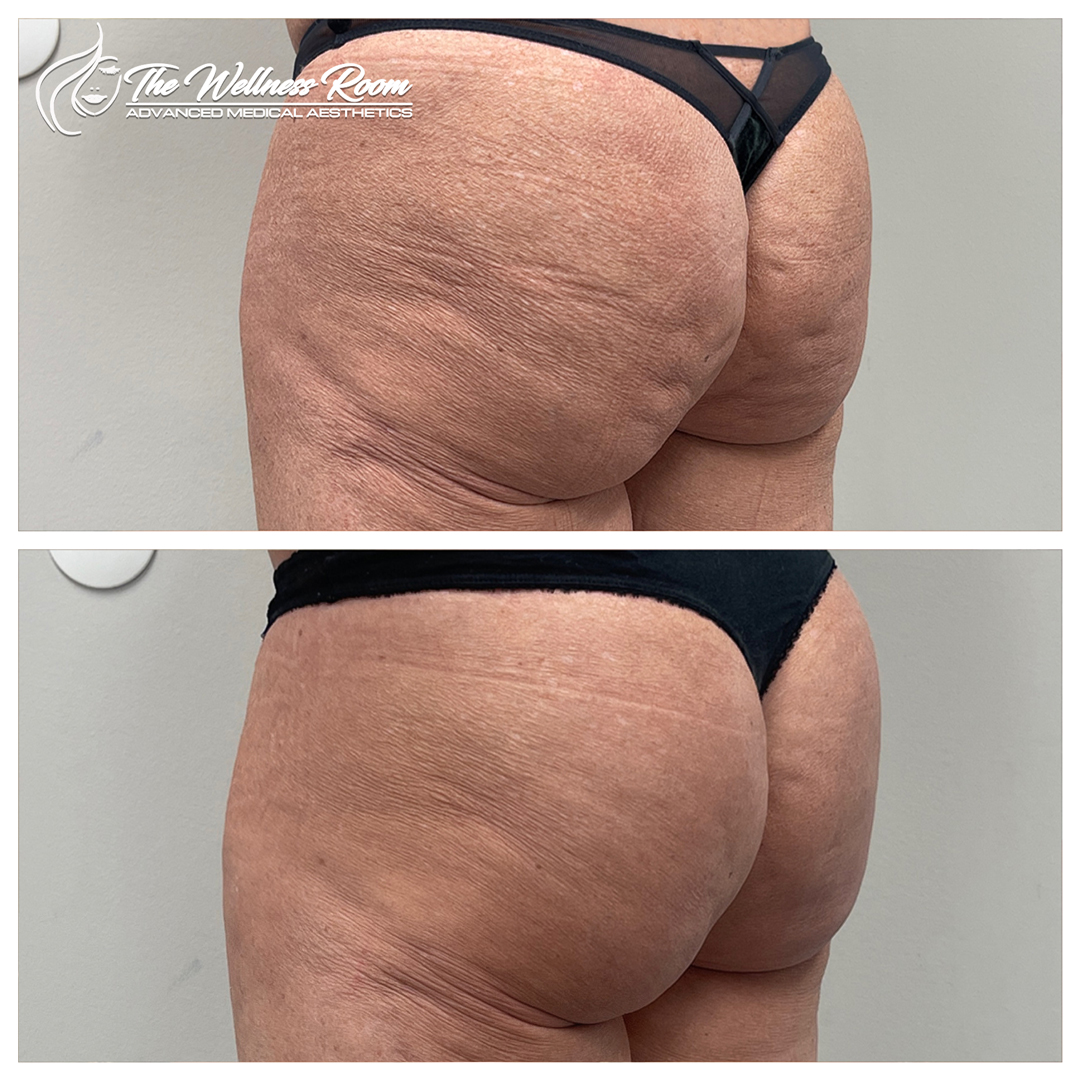 The Wellness Room Skin Wellness Center Knoxville