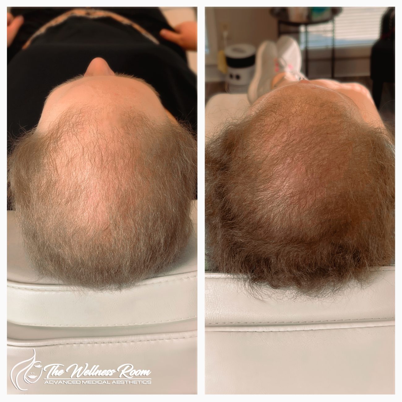 The Wellness Room Skin Wellness Center Knoxville