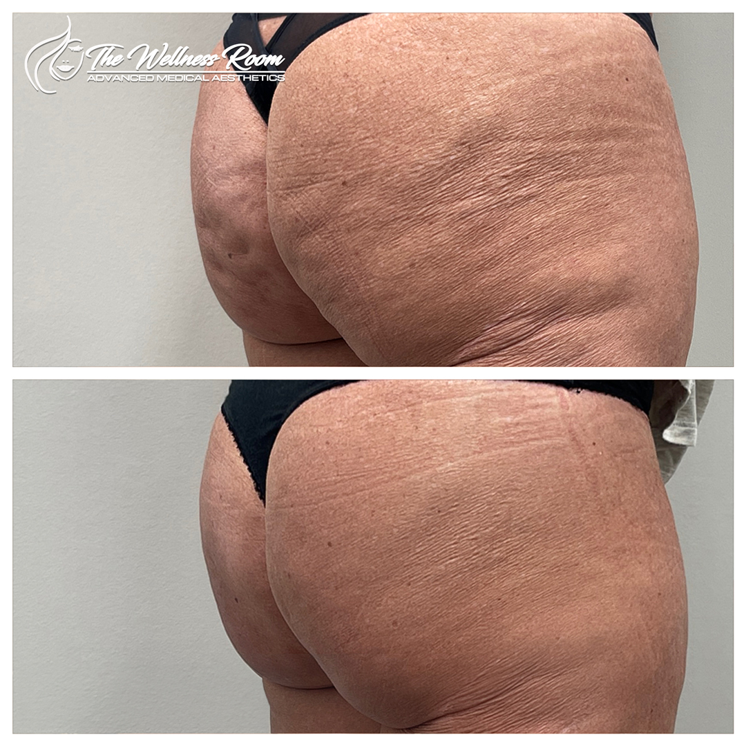 The Wellness Room Skin Wellness Center Knoxville