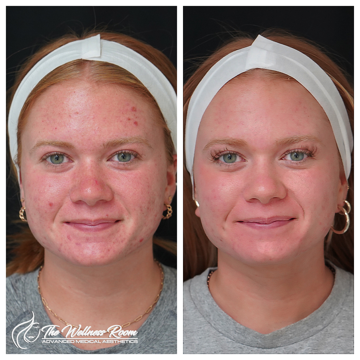 The Wellness Room Skin Wellness Center Knoxville