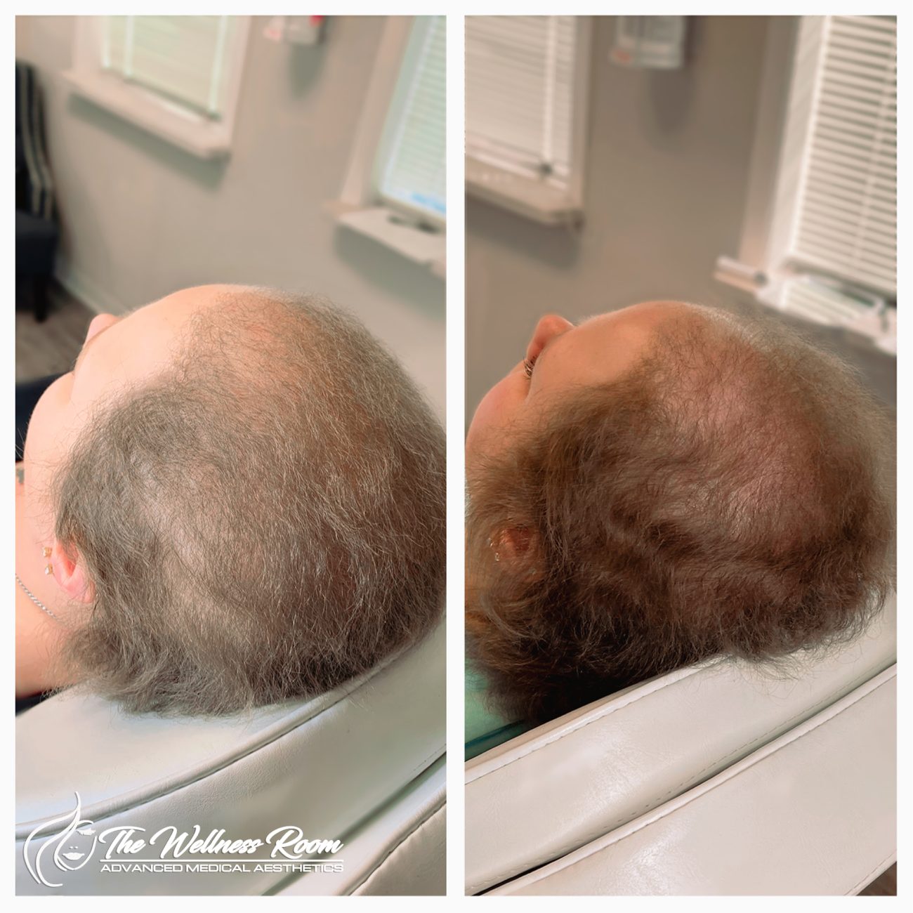 The Wellness Room Skin Wellness Center Knoxville