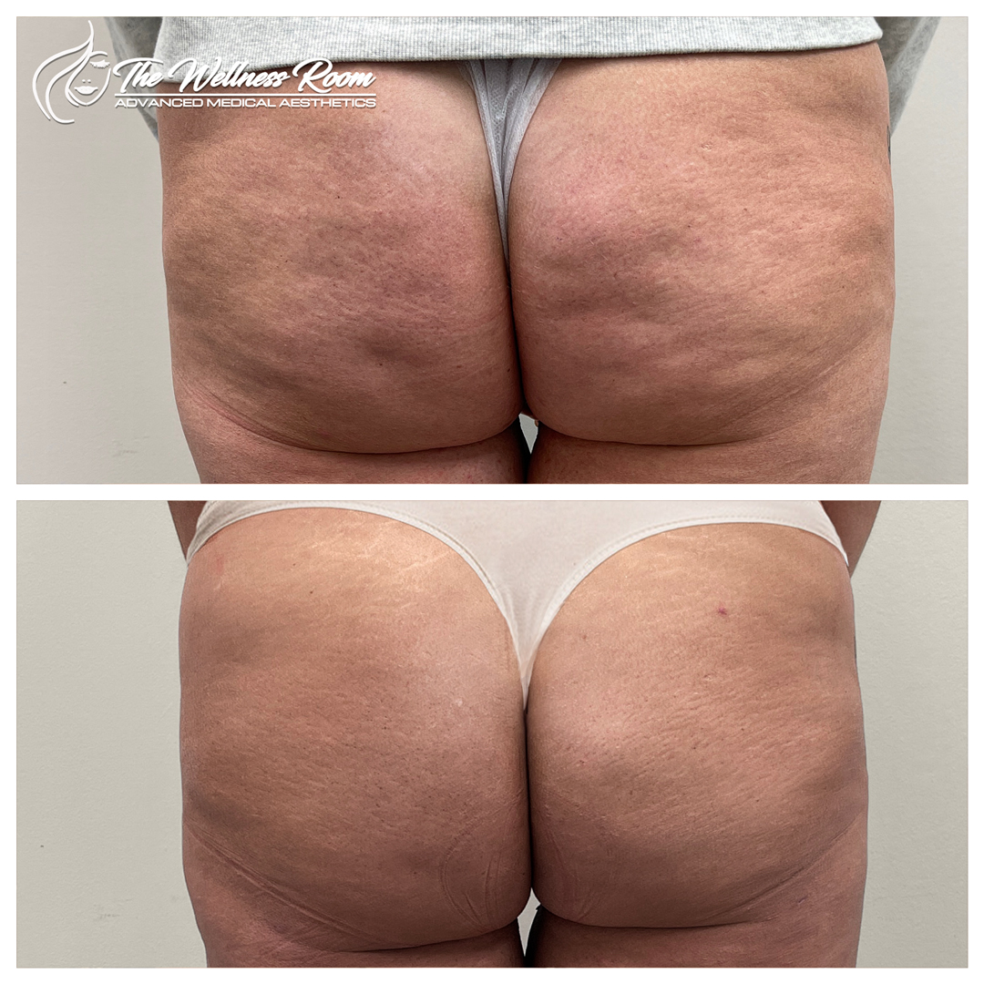 The Wellness Room Skin Wellness Center Knoxville
