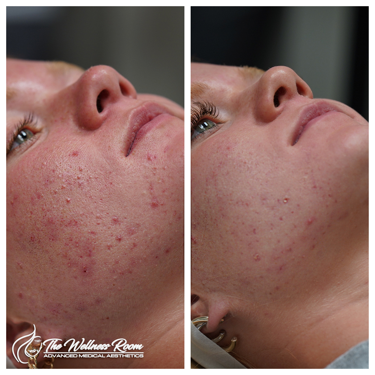 The Wellness Room Skin Wellness Center Knoxville