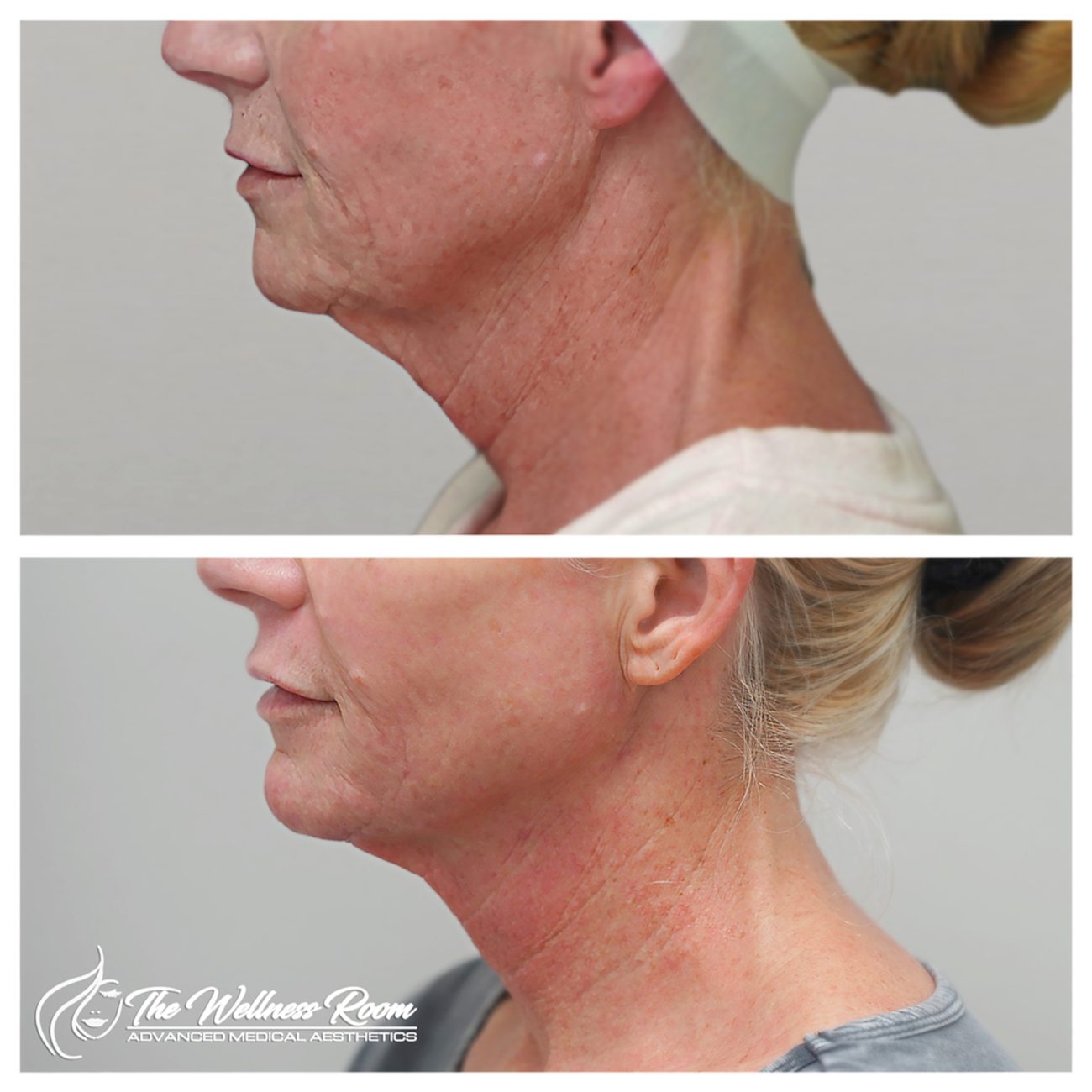 The Wellness Room Skin Wellness Center Knoxville