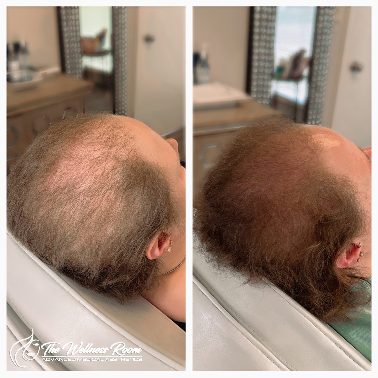 The Wellness Room Skin Wellness Center Knoxville