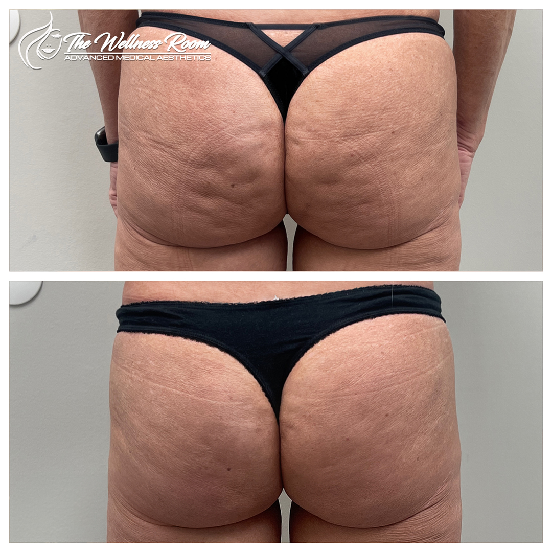 The Wellness Room Skin Wellness Center Knoxville