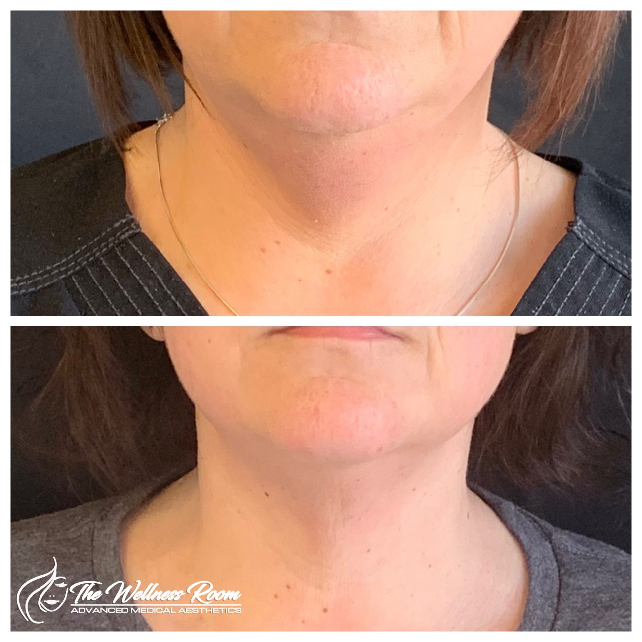 The Wellness Room Skin Wellness Center Knoxville