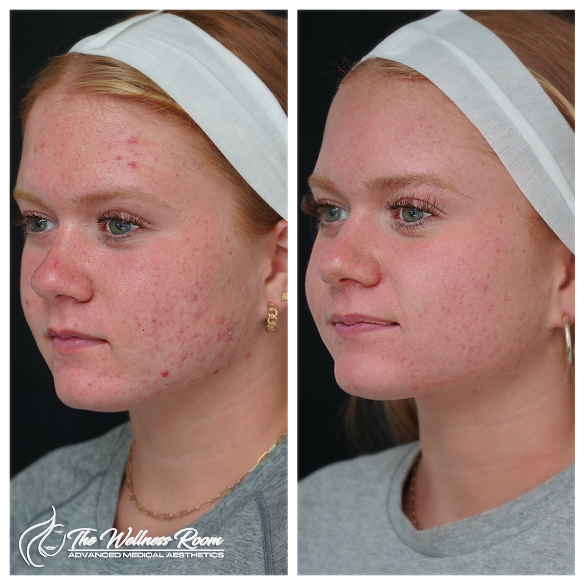 The Wellness Room Skin Wellness Center Knoxville