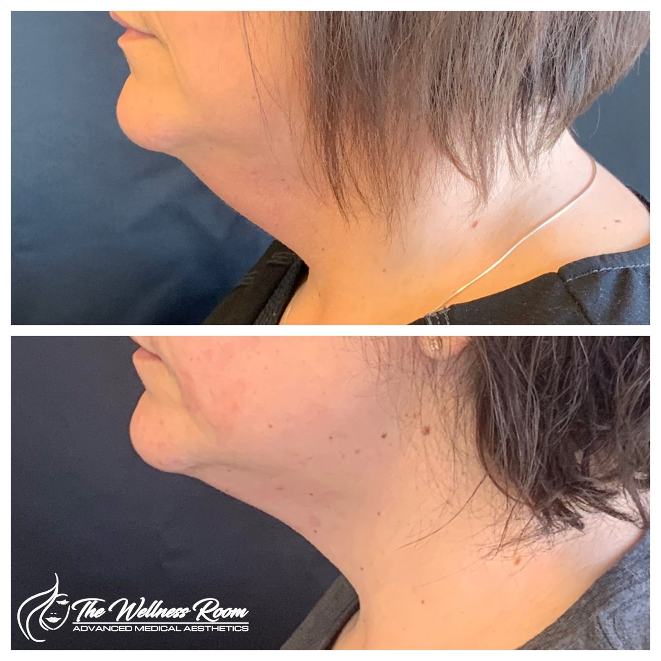 The Wellness Room Skin Wellness Center Knoxville