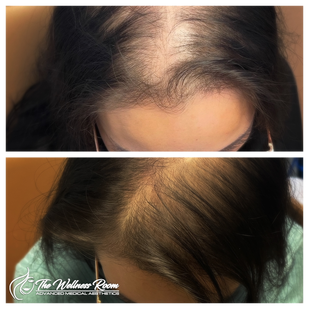 The Wellness Room Skin Wellness Center Knoxville