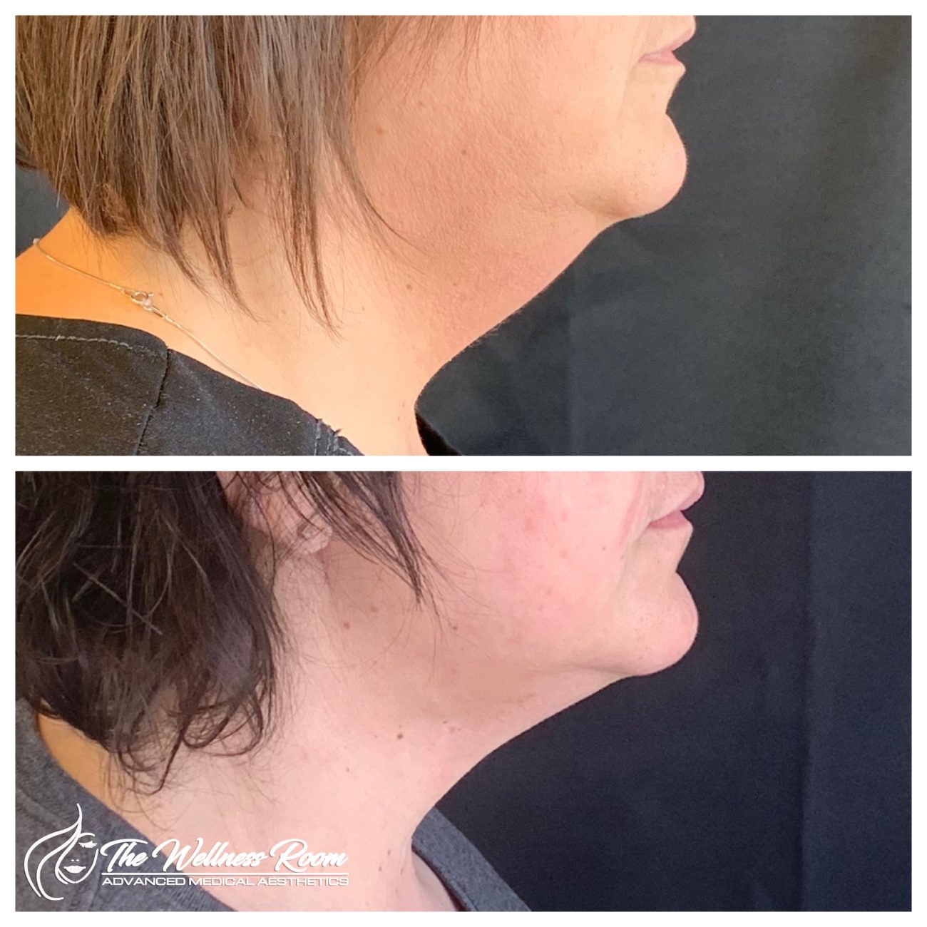 The Wellness Room Skin Wellness Center Knoxville