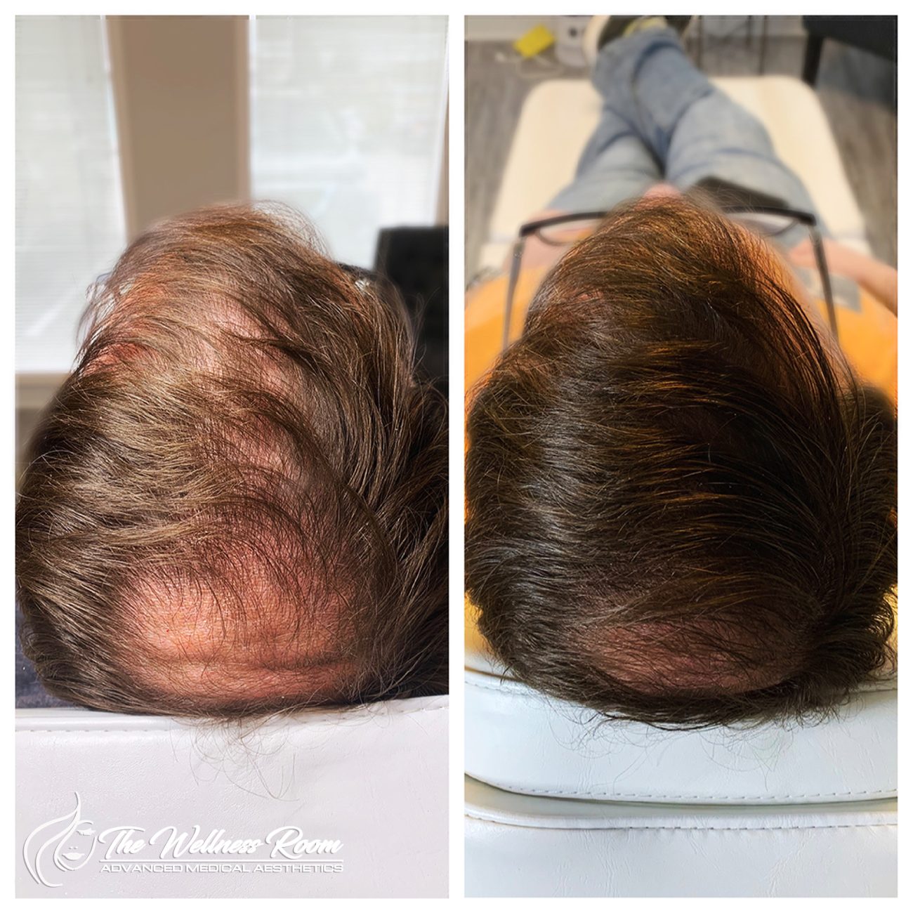 The Wellness Room Skin Wellness Center Knoxville