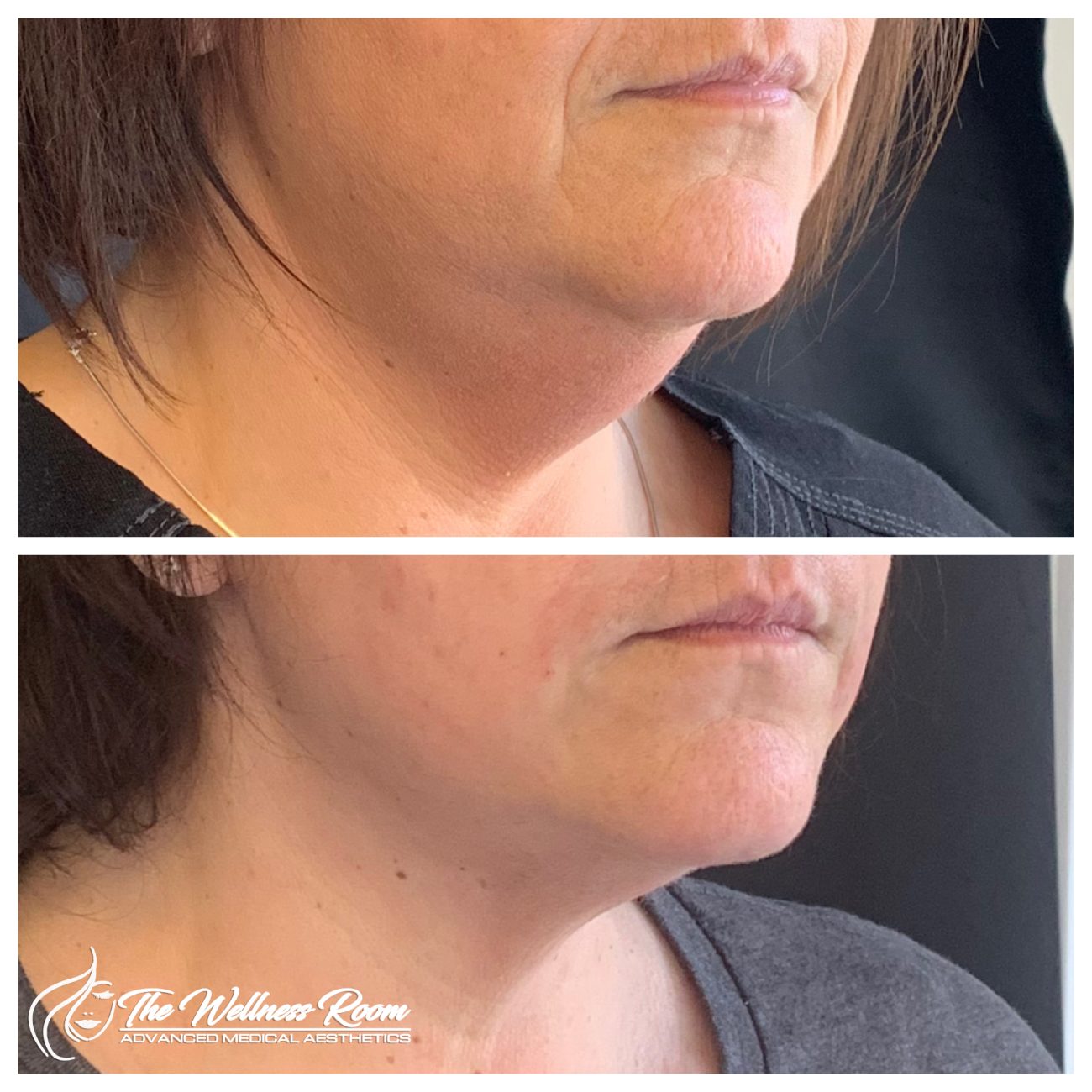 The Wellness Room Skin Wellness Center Knoxville