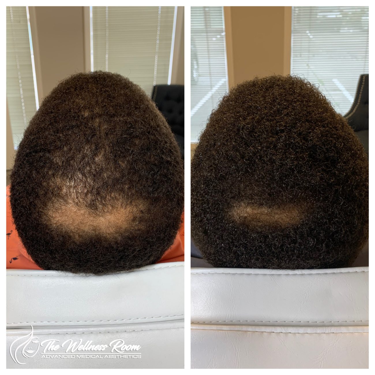 The Wellness Room Skin Wellness Center Knoxville