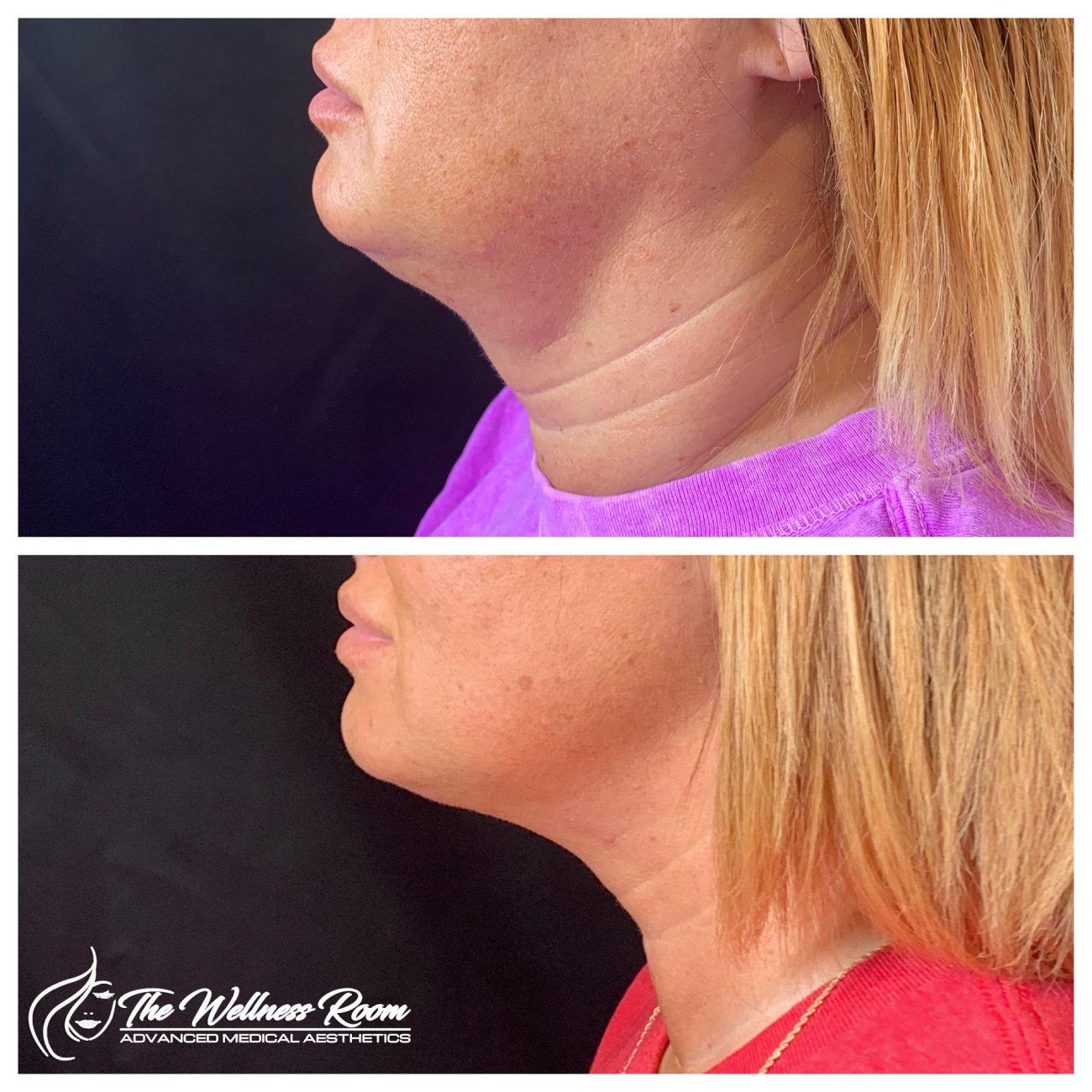 The Wellness Room Skin Wellness Center Knoxville