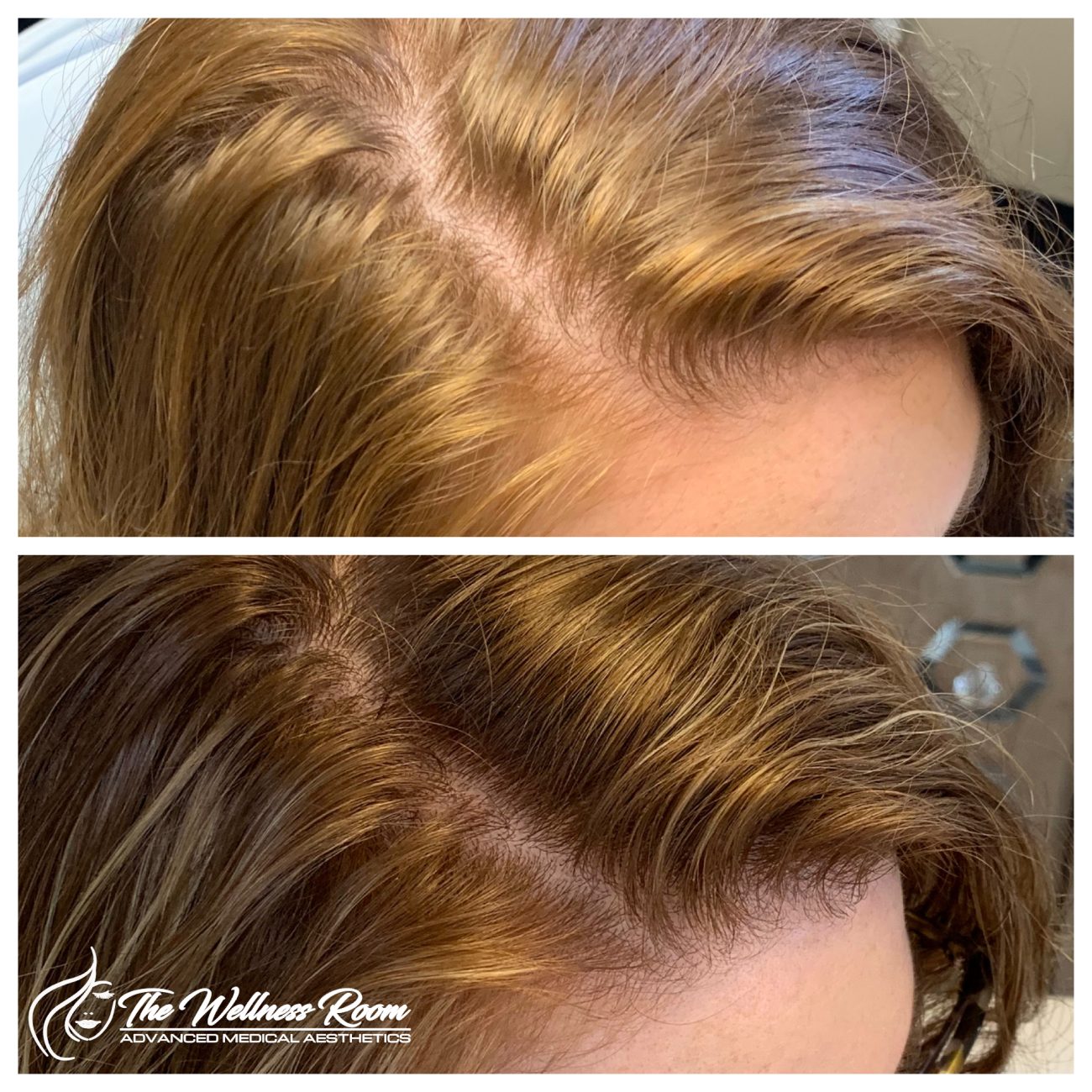 The Wellness Room Skin Wellness Center Knoxville