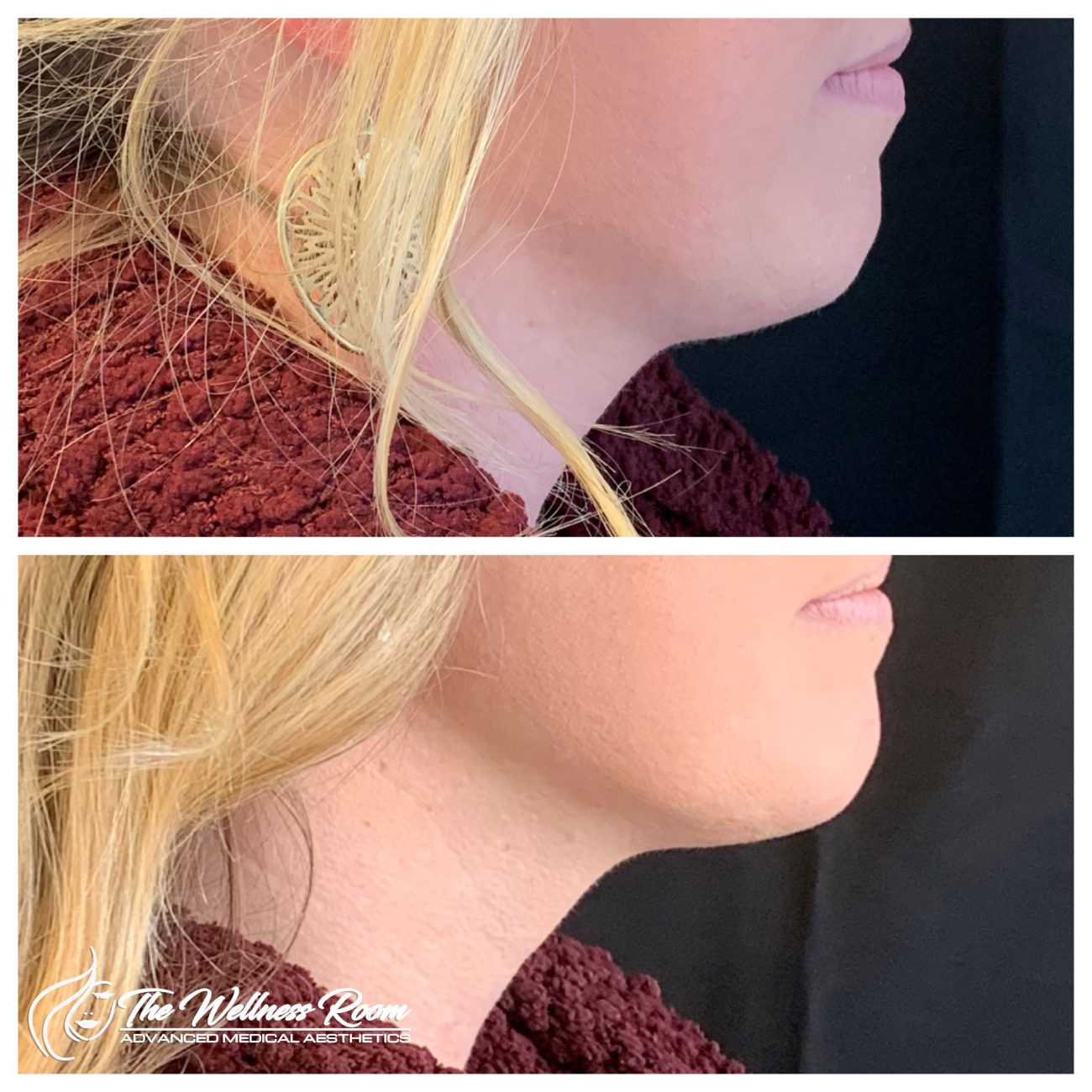 The Wellness Room Skin Wellness Center Knoxville