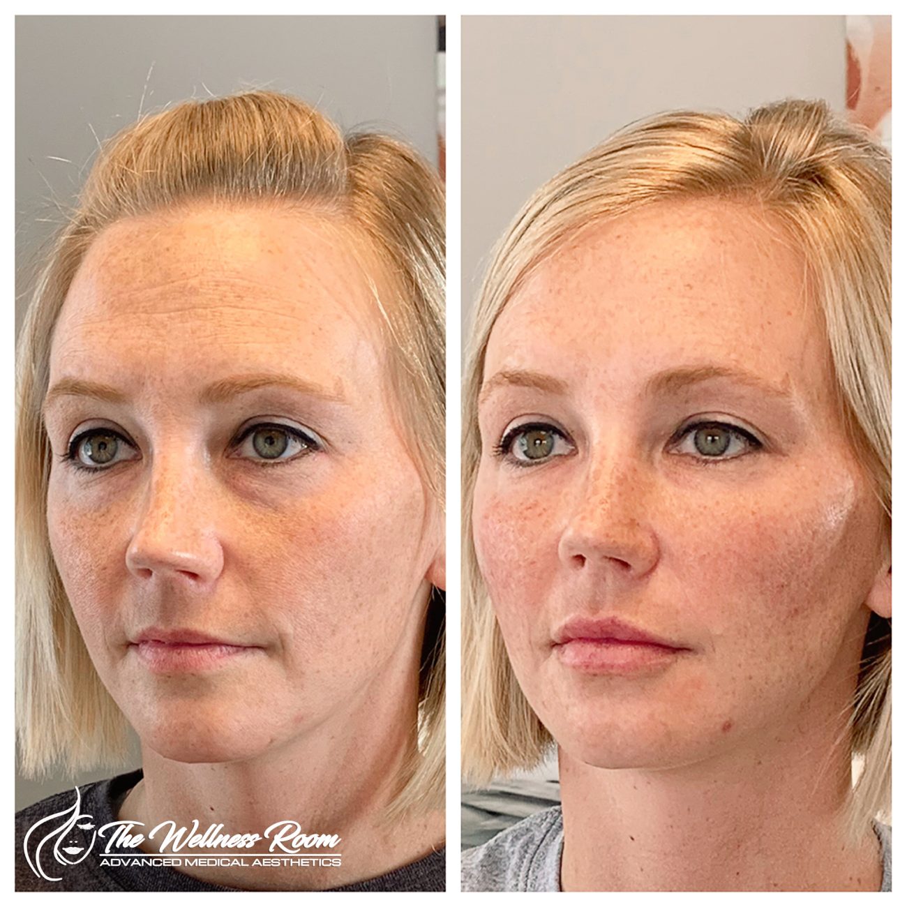 The Wellness Room Skin Wellness Center Knoxville