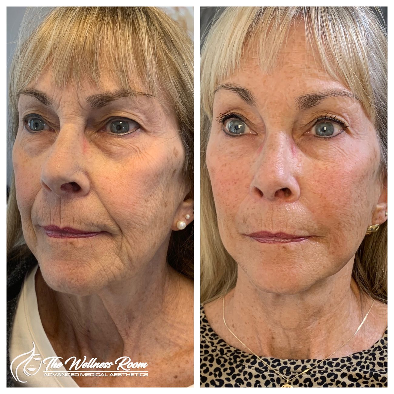 The Wellness Room Skin Wellness Center Knoxville