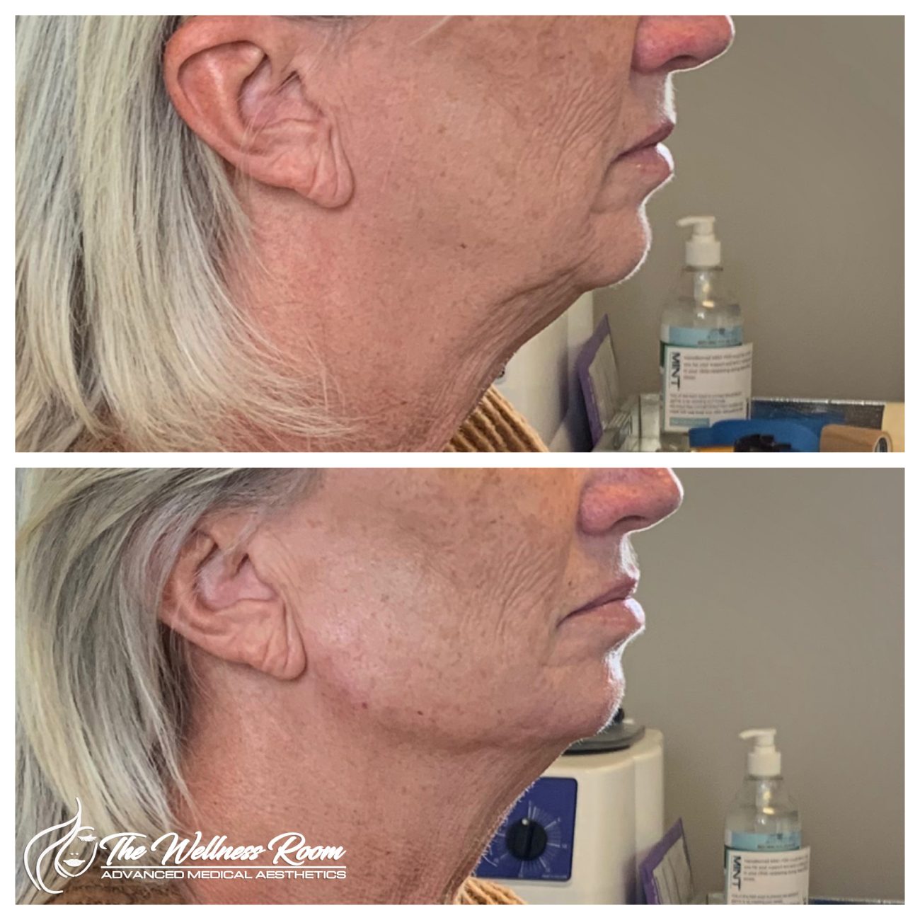 The Wellness Room Skin Wellness Center Knoxville