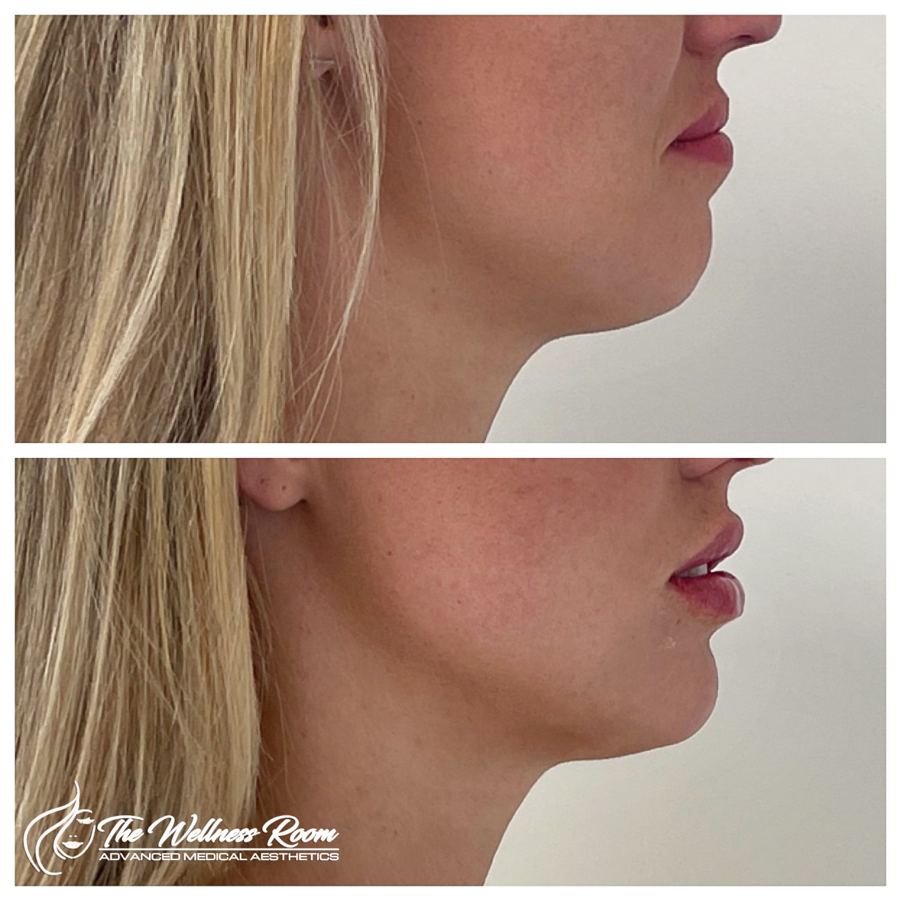 The Wellness Room Skin Wellness Center Knoxville