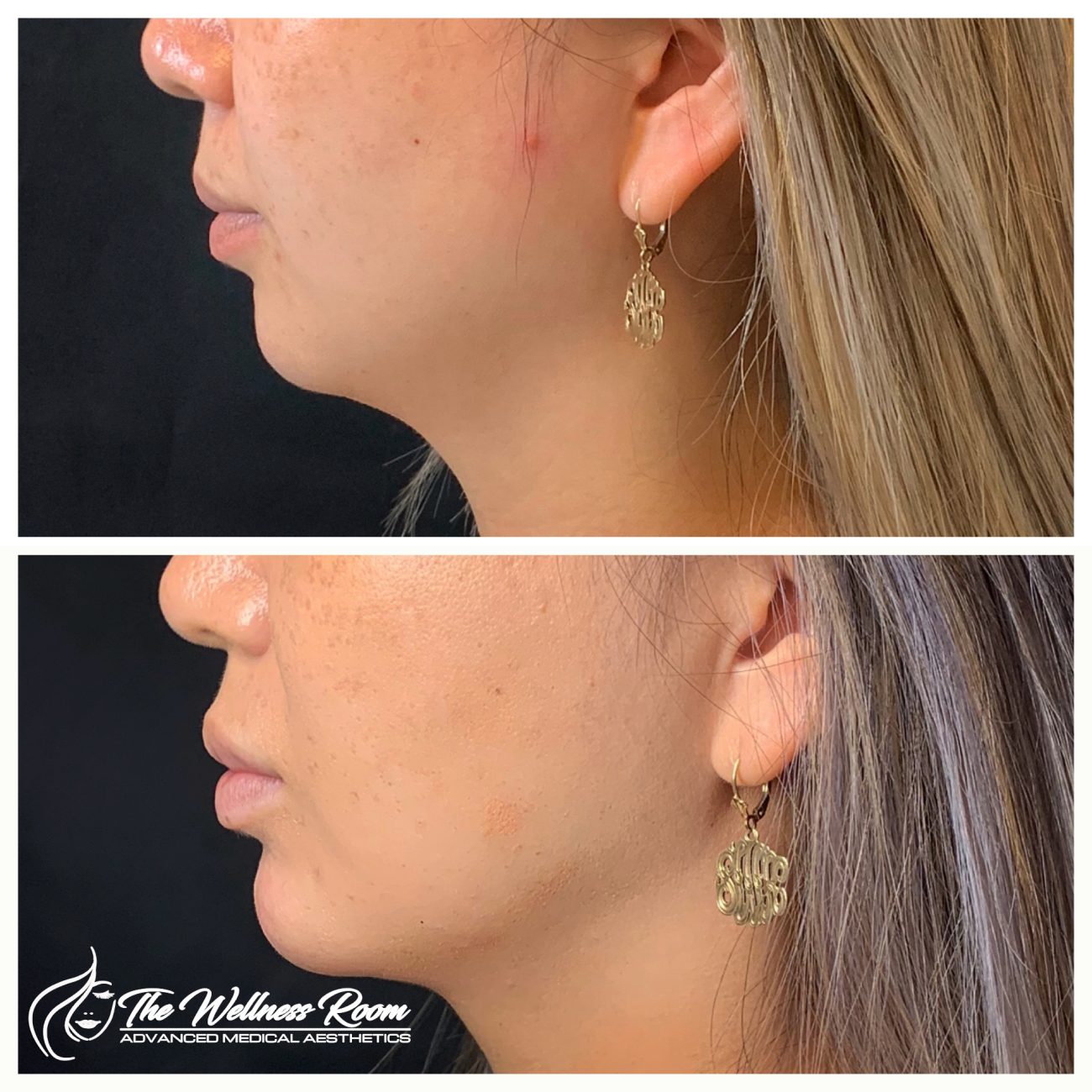 The Wellness Room Skin Wellness Center Knoxville