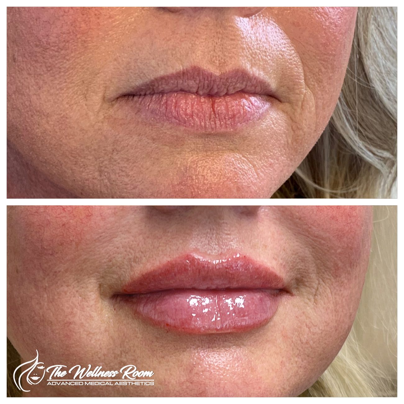 The Wellness Room Skin Wellness Center Knoxville