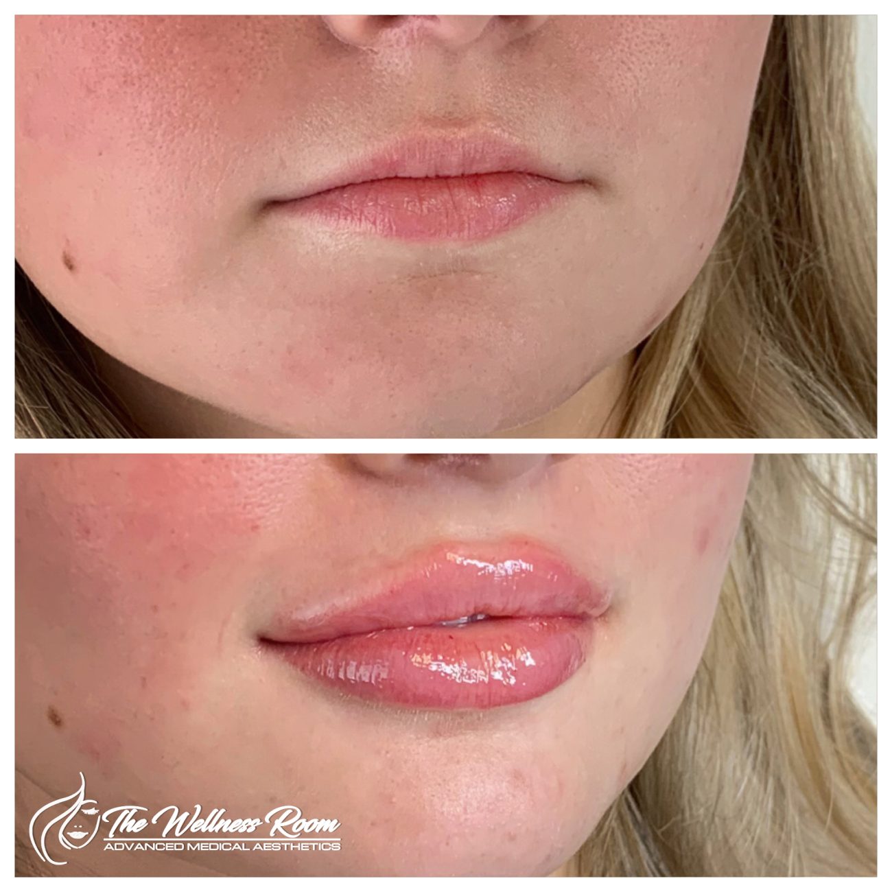 The Wellness Room Skin Wellness Center Knoxville