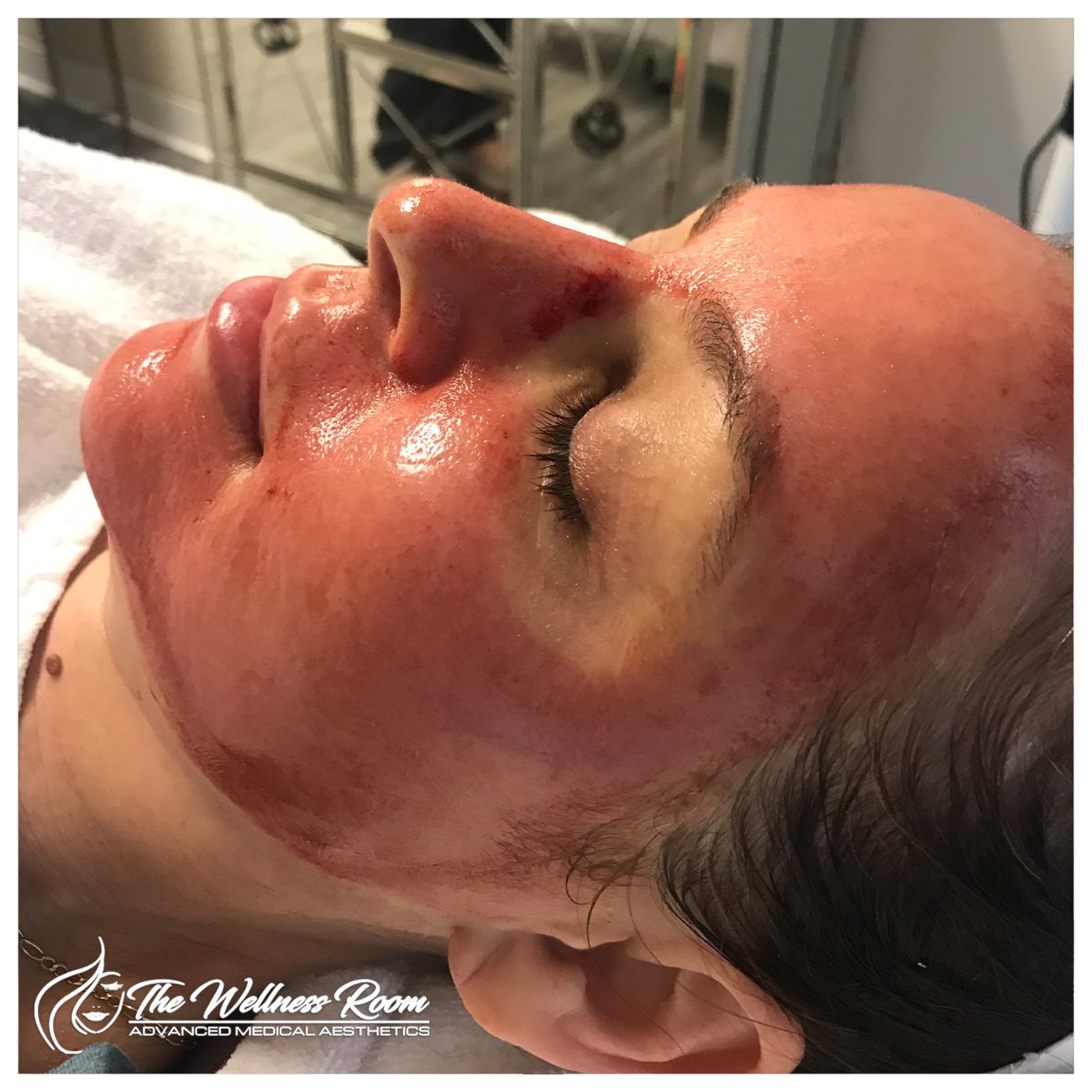 The Wellness Room Skin Wellness Center Knoxville