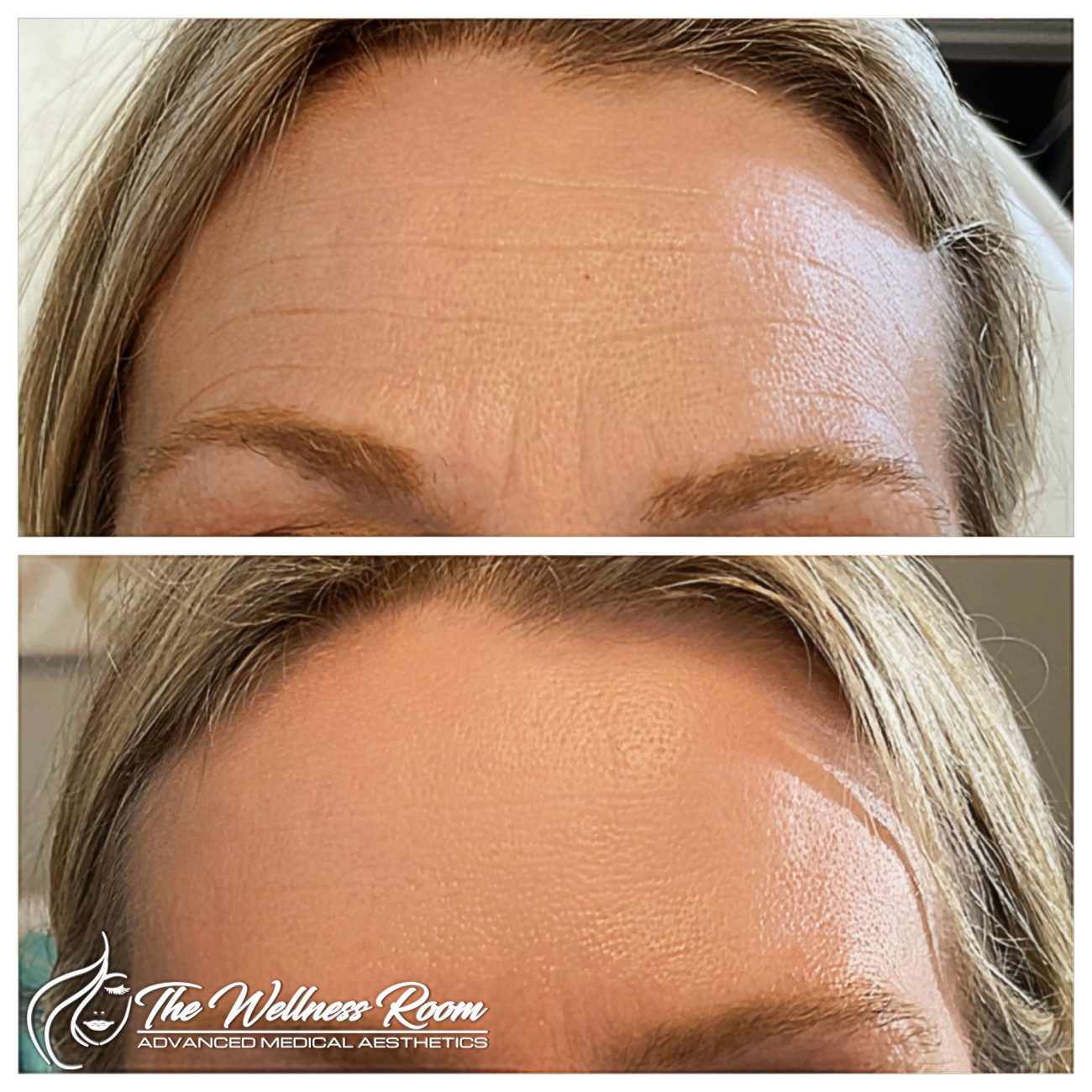 The Wellness Room Skin Wellness Center Knoxville