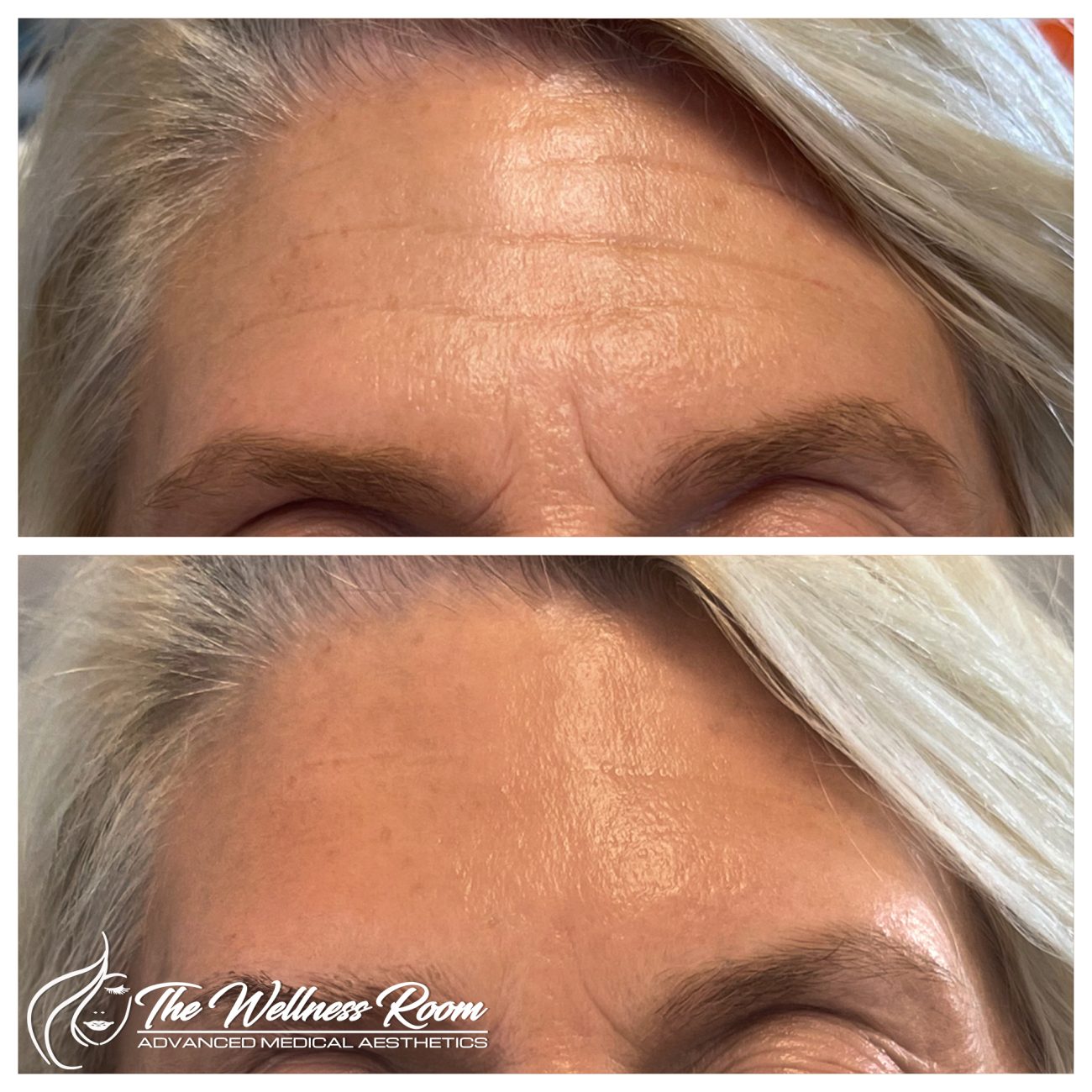 The Wellness Room Skin Wellness Center Knoxville