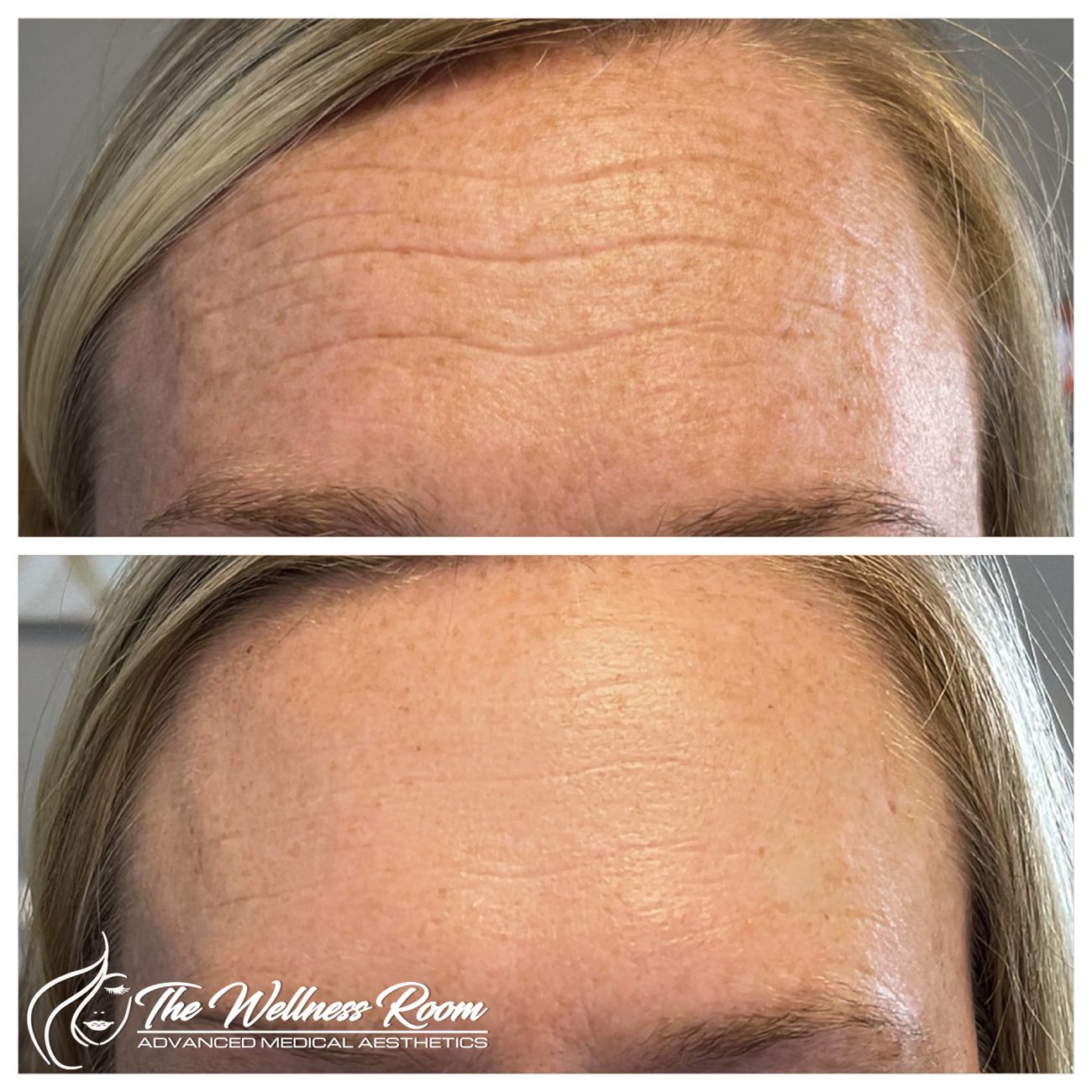 The Wellness Room Skin Wellness Center Knoxville
