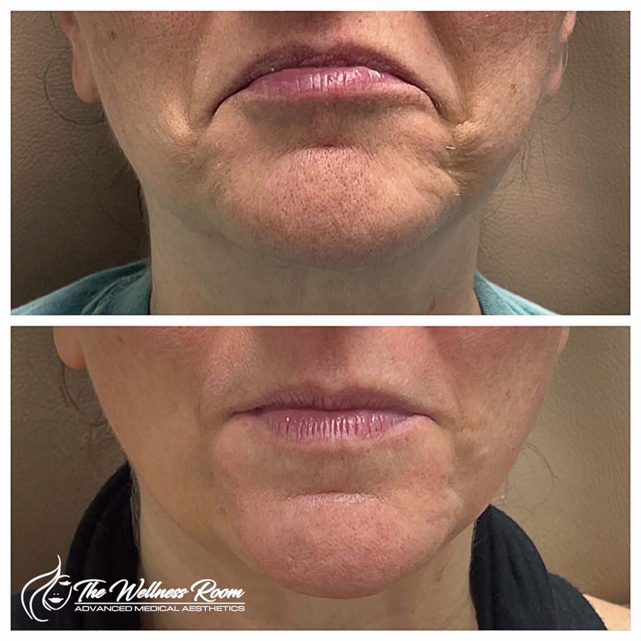 The Wellness Room Skin Wellness Center Knoxville