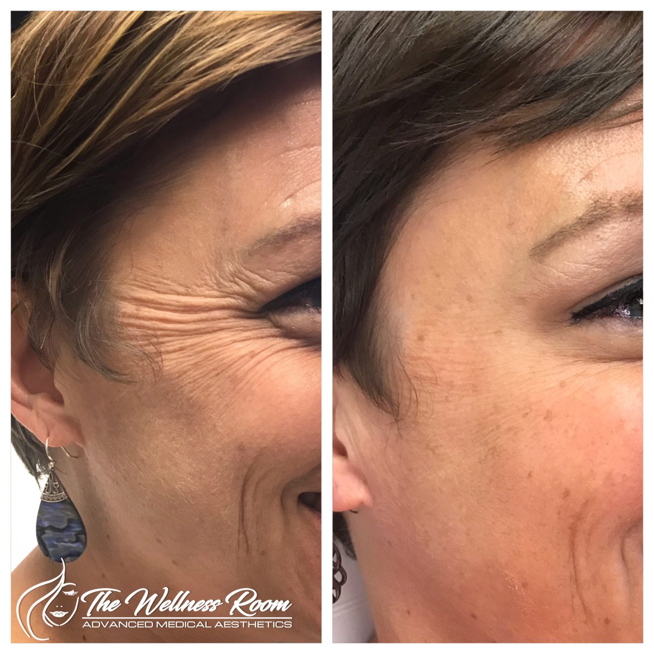 The Wellness Room Skin Wellness Center Knoxville