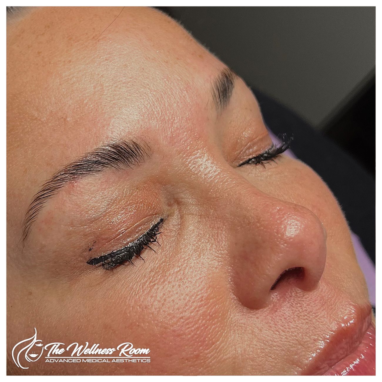 The Wellness Room Skin Wellness Center Knoxville