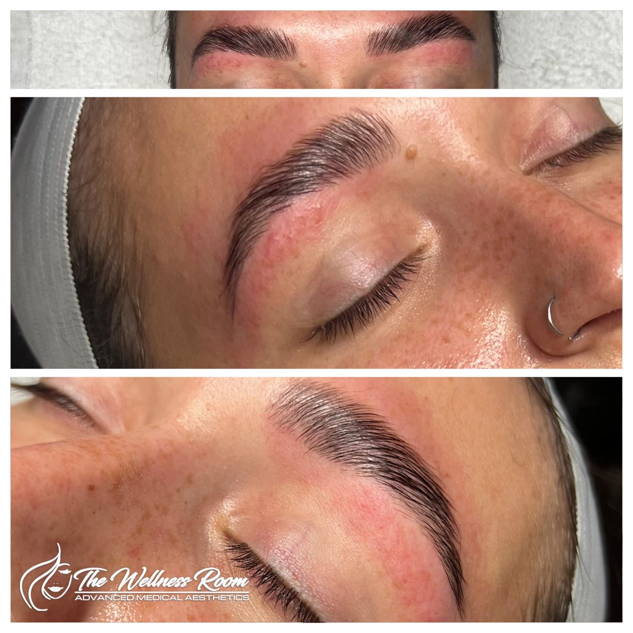 The Wellness Room Skin Wellness Center Knoxville