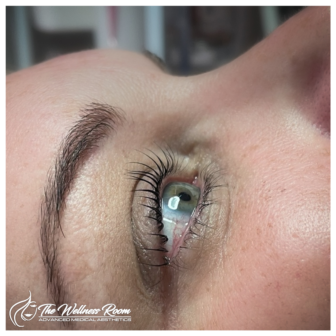 The Wellness Room Skin Wellness Center Knoxville
